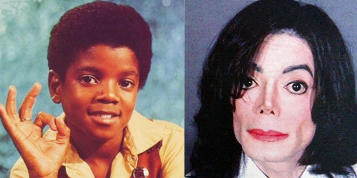 17 Celebs Who Went Under The Knife And Got Absolutely Destroyed