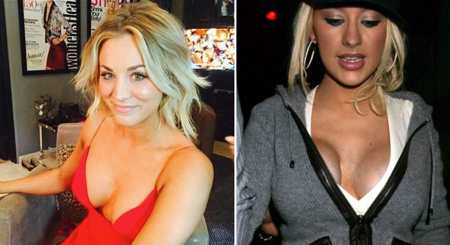 Kate Upton Breast Implants